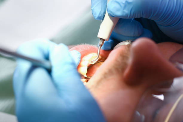 Best Emergency Dental Care for Trauma or Injury in Anson, TX