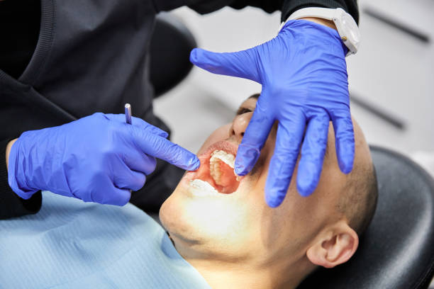 Best Emergency Root Canal Treatment in Anson, TX